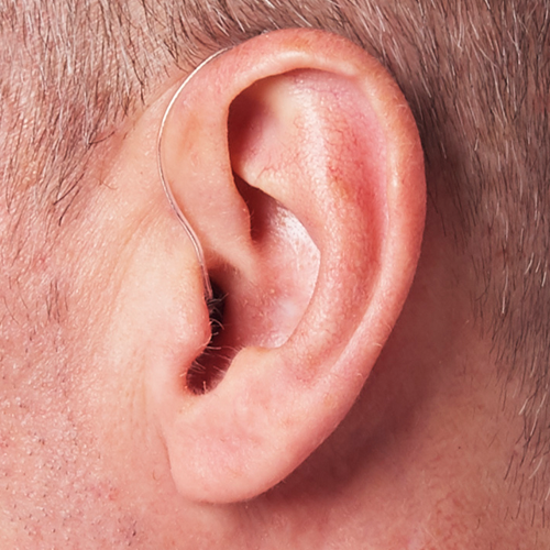 Receiver-In-Canal Hearing Aid with Artificial Intelligence Shown on Ear